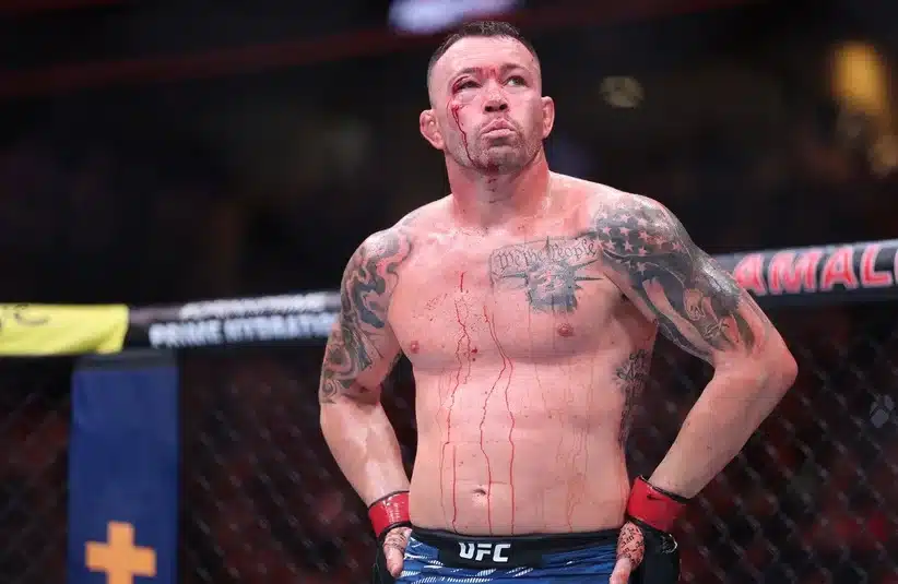 Covington shows bruises on his face